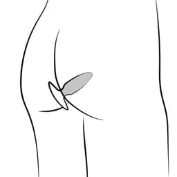 Romp Bass Analvibrator, Gesamtansicht mit Zubehör im Lieferzustand
